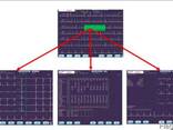 ЭКГ Электрокардиограф 12-канальный ECG-1550, Nihon Kohden - фото 3