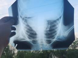 Скупка рентген пленки в таразе