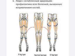 Гучжэнджи түзетуге арналған табандары